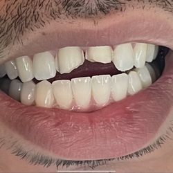 Orange County Dental Care - Before