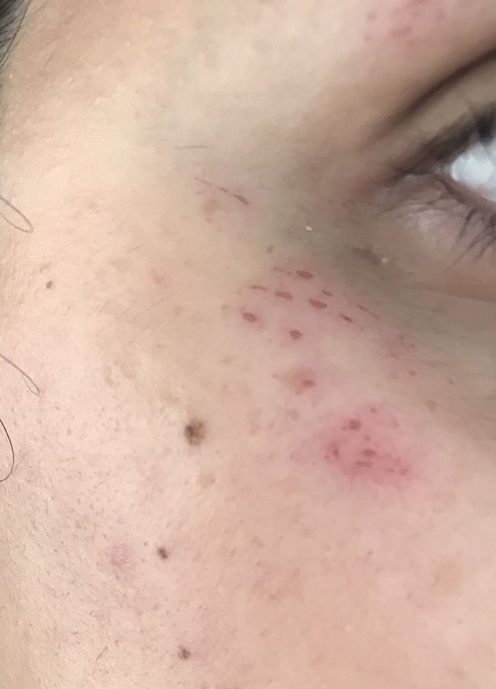 MIRACLE EYEBROWS 4600 Jonestown Rd, Harrisburg, Pennsylvania