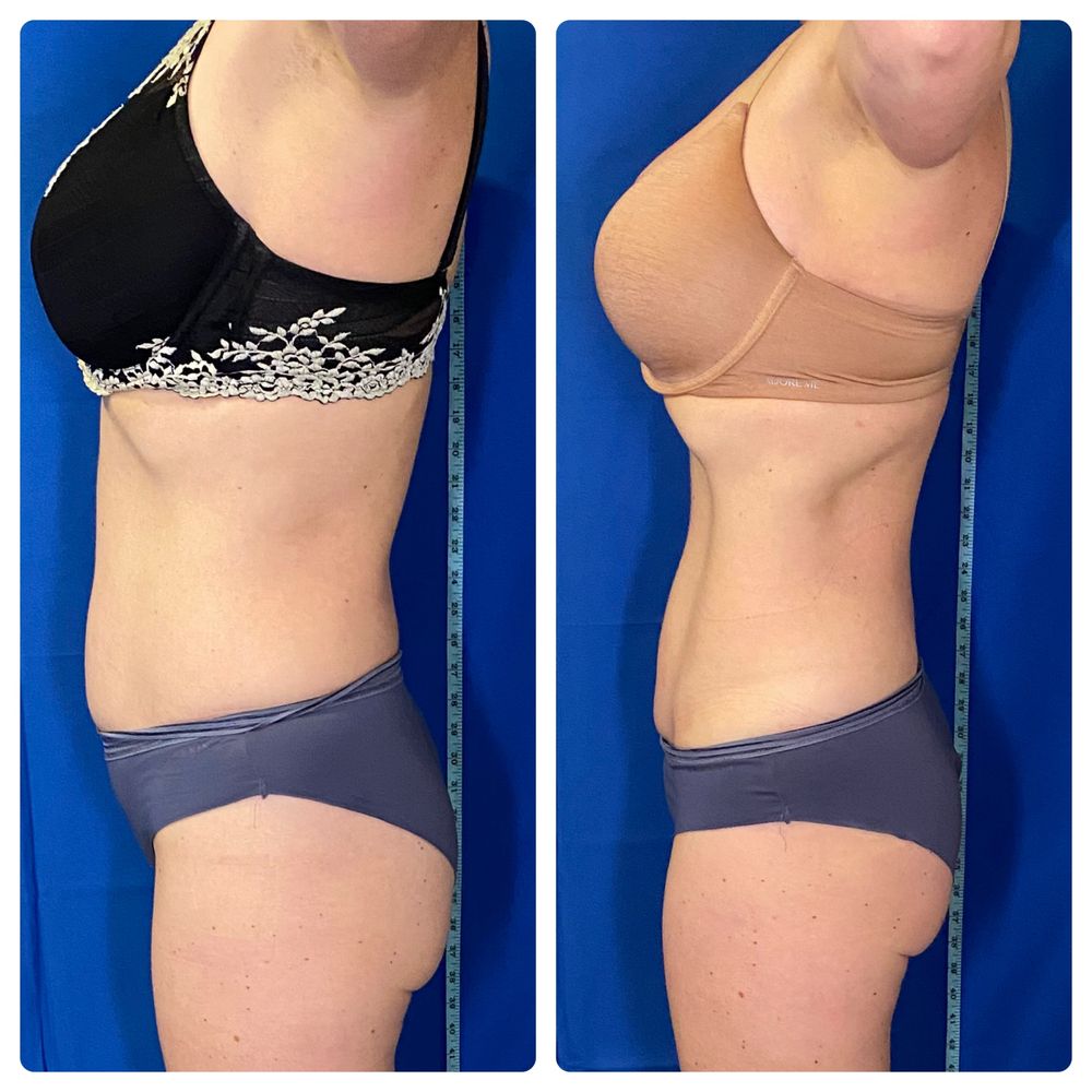 Body Sculpting and Beyond Logo