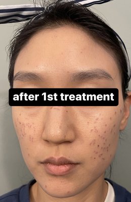 NUGA SKIN CLINIC - 16 Photos - 2005 Boggs Rd, Duluth, Georgia - Skin