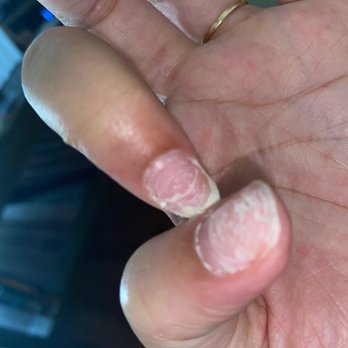 Neu Nails & Spa - extremely painful Cracked nail - Nail Salons Near Me - Henrico, Virginia Neu Nails & Spa - extremely painful Cracked nail - Nail Salons Near Me - Henrico, Virginia