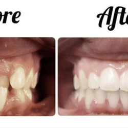My Orthodontist - Cherry Hill