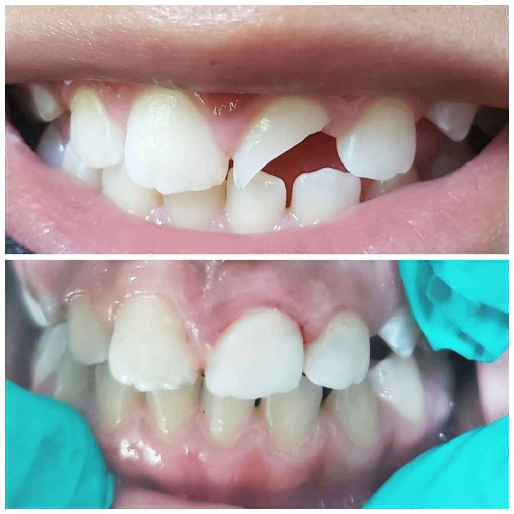 BRIDGEWATER DENTAL ASSOCIATES Updated July 2024 720 US Hwy 202/206