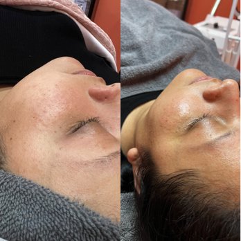 Ulica Skincare - Dermaplaning - Skin Care Near Me - Placentia, California Ulica Skincare - Dermaplaning - Skin Care Near Me - Placentia, California