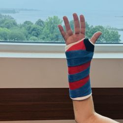University Orthopedics - My new cast