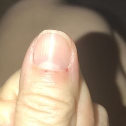 Noire The Nail Bar - Ouch!