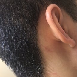 Injury at this barbershop Injury at this barbershop
