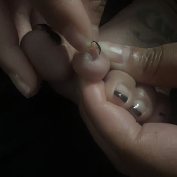 Noire Nail Bar - Very painful before starting antibiotics to cure the infection. - Nail Salons Near Me - Mechanicsville, Virginia Noire Nail Bar - Very painful before starting antibiotics to cure the infection. - Nail Salons Near Me - Mechanicsville, Virginia