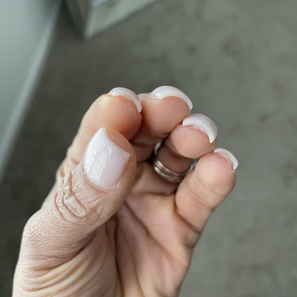 Pronails and Spa in Gainesville - Super super short near the meat of my skin - Hair Removal Near Me - Gainesville, Florida Pronails and Spa in Gainesville - Super super short near the meat of my skin - Hair Removal Near Me - Gainesville, Florida