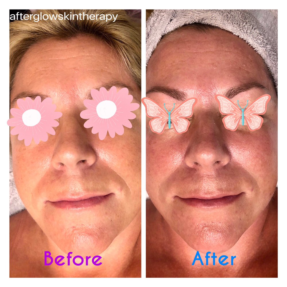 Afterglow Skin Therapy Logo