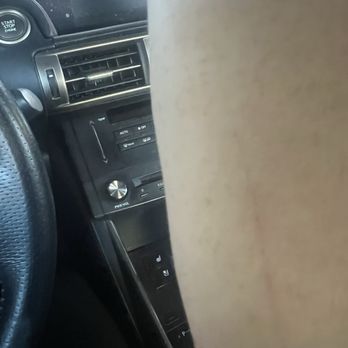 7 Sisters Nail Spa - Scratched up arms from a mani massage. - Nail Salons Near Me - San Mateo, California