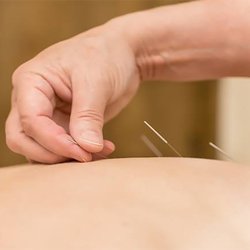 Traditional Oriental Medicine