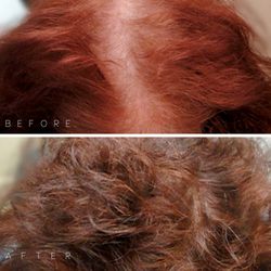 Darling Hair Restoration