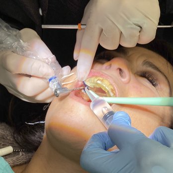 All About Smile Dental Group - Cosmetic Dentists Near Me - Chino, California All About Smile Dental Group - Cosmetic Dentists Near Me - Chino, California