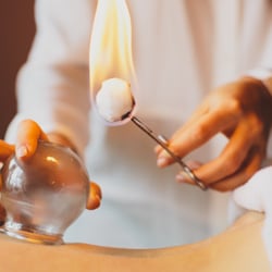 Healing Spots - Fire Cupping Therapy