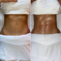 Bodyology Sculpting