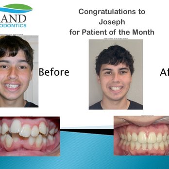 Island Orthodontics - Orthodontists Near Me - Mobile, Alabama