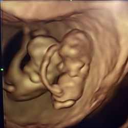 I Saw You First Imaging - Capture these special moments with 3D Ultrasound ,