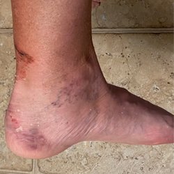 Haskell D Lyle, DPM - North Texas Foot Group