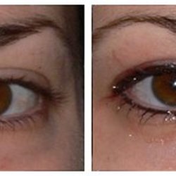 Lasting Looks Permanent Makeup - Eyeliner before, immediately after