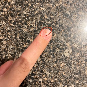 C Nails - Bacteria growing on nail due to poor application of acrylics - Nail Salons Near Me - Miami, Florida