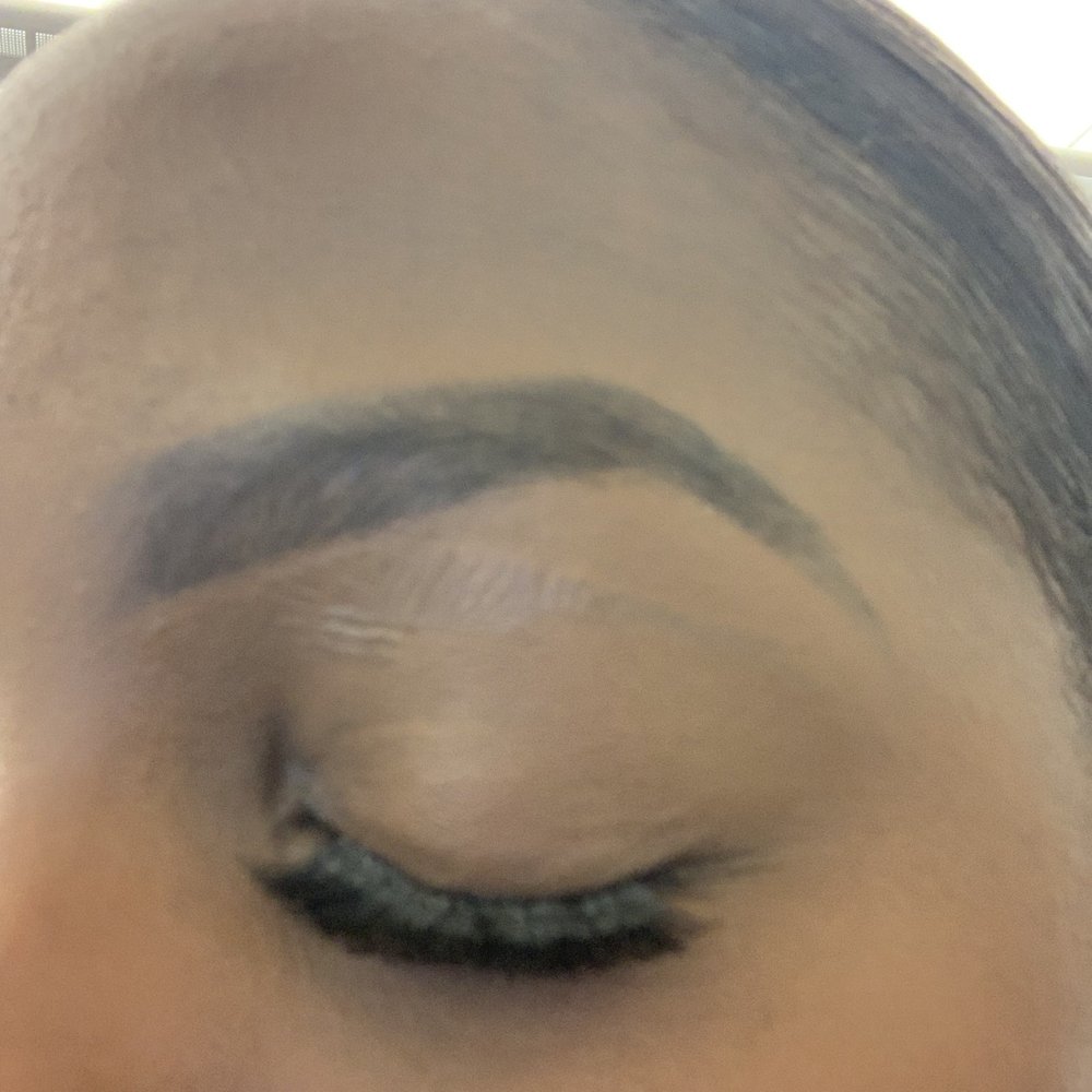 Trying to cover the burns with makeup. Trying to cover the burns with makeup.