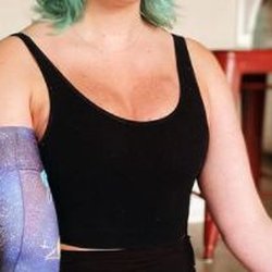 Post reconstruction implants and very even cleavage!