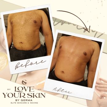 Love Your Skin By Germa - Skin Care Near Me - San Leandro, California Love Your Skin By Germa - Skin Care Near Me - San Leandro, California