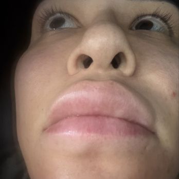 Rady Rahban, MD - Botch - Cosmetic Surgeons Near Me - Beverly Hills, California Rady Rahban, MD - Botch - Cosmetic Surgeons Near Me - Beverly Hills, California