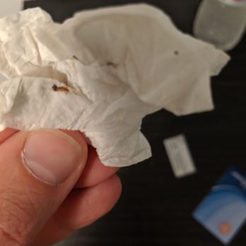 Pembroke Inn - Dead bed bug. - Hotels Near Me - Toronto, Ontario Pembroke Inn - Dead bed bug. - Hotels Near Me - Toronto, Ontario