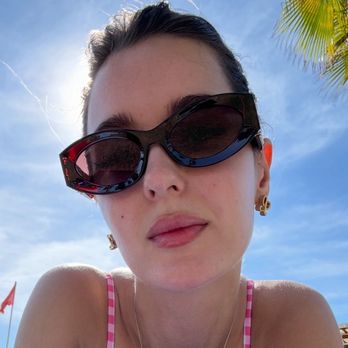 Eclipse Aesthetics - My healed lips - Aestheticians Near Me - Staten Island, New York Eclipse Aesthetics - My healed lips - Aestheticians Near Me - Staten Island, New York