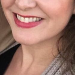 Summer Creek Dental - What my smile was with 2 front teeth And now Front 2 teeth are short and thin Because of Dr Thibodeaux