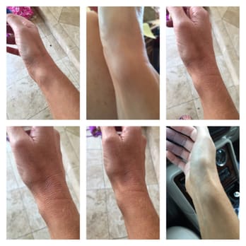 Tze C. Ip, MD - My wrist causing severe pain that Dr. Ip said should not be causing me pain. Had surgery with Dr. Dao, a very competent Dr. - Orthopedists Near Me - Newport Beach, California Tze C. Ip, MD - My wrist causing severe pain that Dr. Ip said should not be causing me pain. Had surgery with Dr. Dao, a very competent Dr. - Orthopedists Near Me - Newport Beach, California