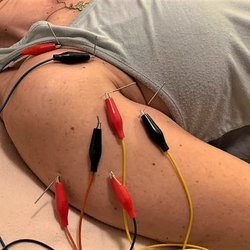East West Sports Acupuncture & Orthopaedics