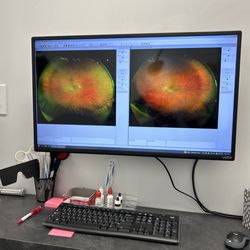 Lowcountry Eye Care - North Mount Pleasant - My eyes!!