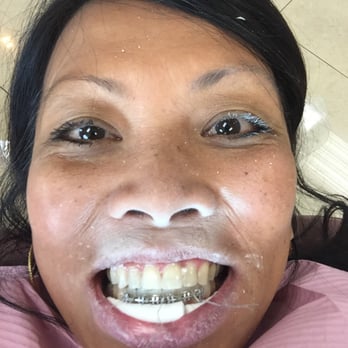 Brenn Orthodontics - Orthodontists Near Me - Burbank, California