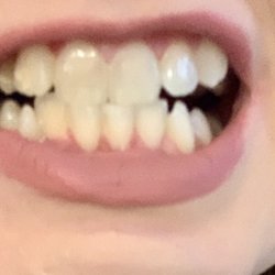 The New Canvas - Before whitening
