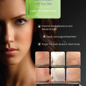 Solutions Laser Studio - Revitalize Your Skin - Laser Hair Removal Near Me - Naperville, Illinois Solutions Laser Studio - Revitalize Your Skin - Laser Hair Removal Near Me - Naperville, Illinois