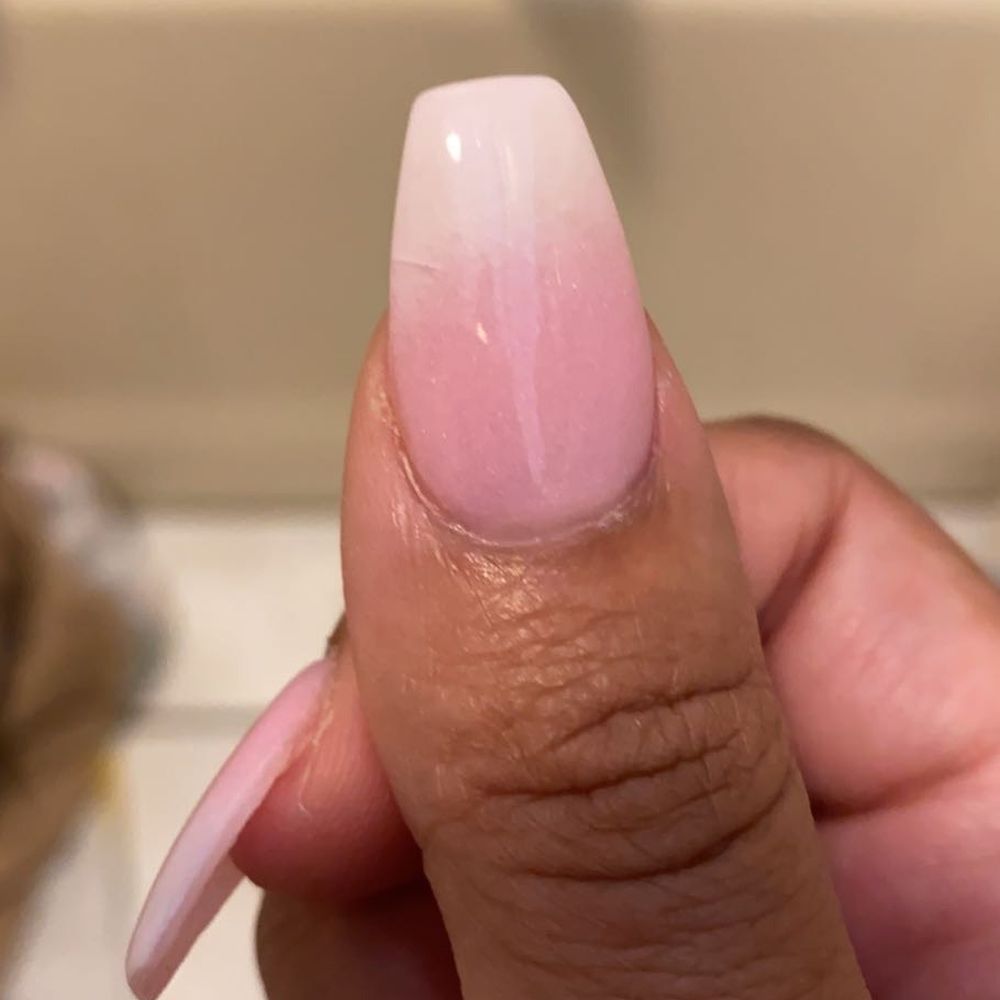 American Nails Spa - Crack in my thumb nail. I went back to have it fixed the next day. She couldn't explain the cracking. It was too much dip powder. - Skin Care Near Me - Norwood, Massachusetts American Nails Spa - Crack in my thumb nail. I went back to have it fixed the next day. She couldn't explain the cracking. It was too much dip powder. - Skin Care Near Me - Norwood, Massachusetts
