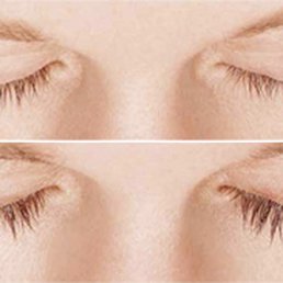 93+ Great Gentle Aesthetics Medical Spa Pictures