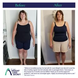 St Louis Weight Loss Secret - Customer Before & After photo
