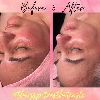 The G Spot Aesthetics - Get N' Glow Facial - Skin Care Near Me - Las Vegas, Nevada The G Spot Aesthetics - Get N' Glow Facial - Skin Care Near Me - Las Vegas, Nevada