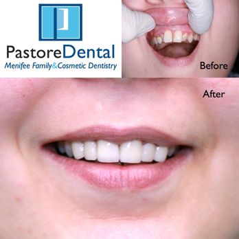 Frank Pastore, DDS - Cosmetic Dentists Near Me - Menifee, California