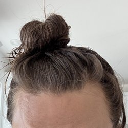 Catara Med Spa - Moved to Algonquin - Terrible Xeomin application