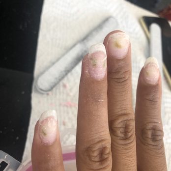 Natomas Nails - Mold - Nail Salons Near Me - Sacramento, California