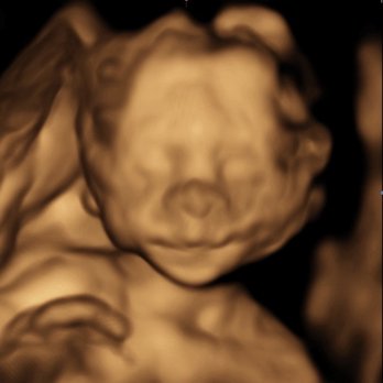 Womb's View - a snapshot of our little man - Ultrasound Imaging Centers Near Me - Modesto, California Womb's View - a snapshot of our little man - Ultrasound Imaging Centers Near Me - Modesto, California