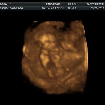 Baby's First Photos - Terrible us shots - Diagnostic Imaging Near Me - Bakersfield, California