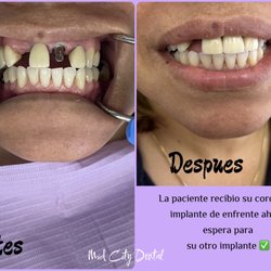 Mid City Dental - Happy Patient!