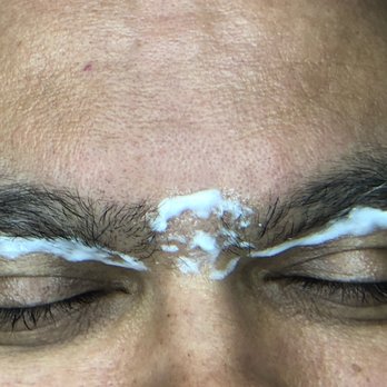Pilosity Studio - Male eyebrows. Numbing cream application. #supernumb #electrolysis #permanenthairremoval #pilosityperfect #pilositypro - Skin Care Near Me - Pasadena, California Pilosity Studio - Male eyebrows. Numbing cream application. #supernumb #electrolysis #permanenthairremoval #pilosityperfect #pilositypro - Skin Care Near Me - Pasadena, California
