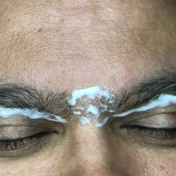 Pilosity Studio - Male eyebrows. Numbing cream application. #supernumb #electrolysis #permanenthairremoval #pilosityperfect #pilositypro